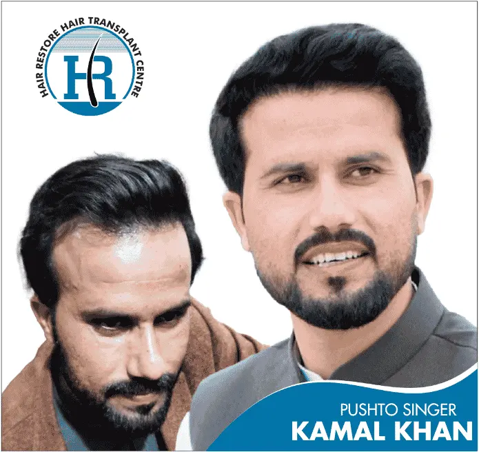 KAMAL KHAN PUSHTO SINGER KAMAL KHAN PUSHTO SINGER