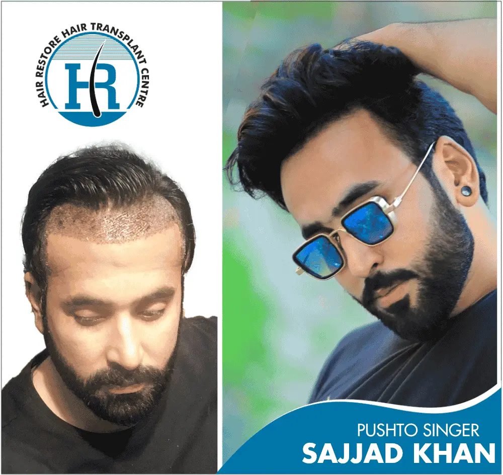 SAJJAD KHAN PUSHTO SINGER SAJJAD KHAN PUSHTO SINGER